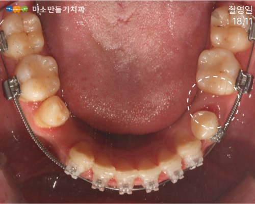 8dbb9c7678773e518044acaf7f402b62_004 (1).png